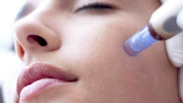 Microneedling bei LixSkin